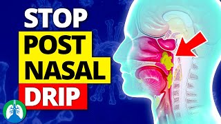 Top 10 Ways to Stop a Cough from Postnasal Drip [upl. by Nnaegroeg241]