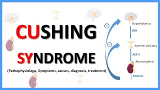 Cushing SyndromeCauses Clinical features Diagnosis Treatment Pathophysiology [upl. by Enaillil]