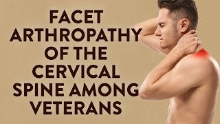 Facet arthropathy of the cervical spine among Veterans [upl. by Owain]