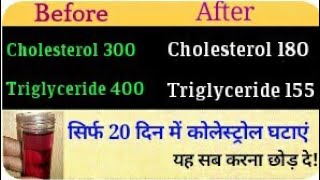 सिर्फ 20 दिन में कोलेस्ट्रोल triglycerides को सामान्य करे tips to control high triglycerides [upl. by Adnanref]