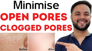 Open PoresClogged Pores amp Enlarged Pores Solution with Home Remedies [upl. by Sanders]