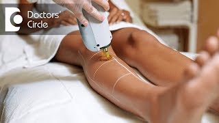 Top benefits of laser hair removal  Dr Priya J Talageri [upl. by Dayna]