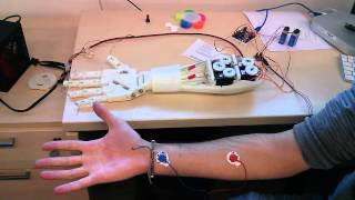 Roujin Project  InMoov Arm and EMG 1 [upl. by Hesler217]