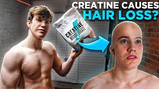 Does Creatine Cause Hair Loss [upl. by Ilhsa55]