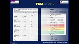 Thrombectomy in pulmonary embolism [upl. by Tnecnivleahcim]