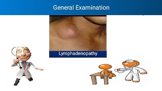 General Examination  Lymphadenopathy  Clinical significance of Lymphadenopathy  Virchow Nodes [upl. by Acinorav]