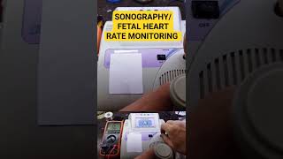 sonography fetal heart rate monitoring opamps how to repairLM324N [upl. by Fin]