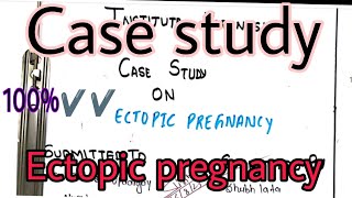 CASE Study on ectopic pregnancy case presentation on ectopic pregnancy NCP on ectopic pregnancy [upl. by Paske]