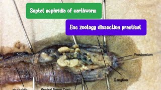 Septal nephridia of earthworm dissection BSc zoology 5 semester [upl. by Andres813]