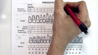 Periodontal Examination Series 13 Periodontal Charting Form [upl. by Rundgren646]