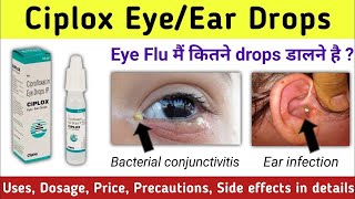 Ciplox eye drops use dose side effects and benifitsEye infection treatmentEye Redness  Eye Flue [upl. by Nilcaj]