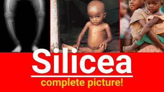 Silicea homeopathic medicine  Silicea complete picture  In which potency silicea is used for boil [upl. by Yebot]