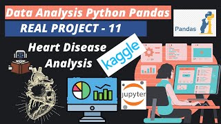 16 Heart Disease Analysis  Python Pandas Project [upl. by Pilar]