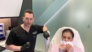 Female Facial Sculpting with Belotero  Smokers Lines and Lip Rejuvenation  West Hollywood CA [upl. by Tini]