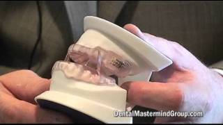 SomnoDent MAS Sleep Apnea Oral Appliance [upl. by Hazrit]