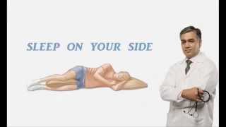 How To Stop Snoring Naturally  Tip 1 [upl. by Accalia]