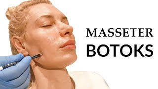 Masseter Botox Nasıl Yapılır  Yüz ve Masseter Botoks Uygulama Videosu  Botoks Uygulama Videoları [upl. by Aronael]