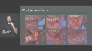 Principles of Implant Occlusion [upl. by Aivad580]