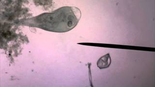 Live Stentor Swimming and Engorged on Euglena [upl. by Enohsal]