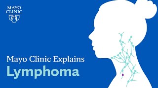 Mayo Clinic Explains Lymphoma [upl. by Analle]