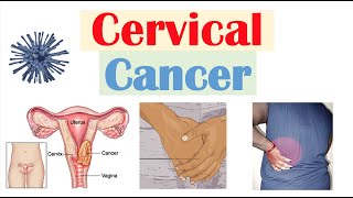 Cervical Cancer Risk Factors Pathophysiology Symptoms Staging Diagnosis Treatment amp Prevention [upl. by Haroppiz]