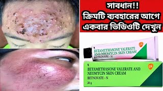 Betnovate n skin cream  বেটনোভেট এন ক্রিম এর কাজ কি ত্বক ফর্সাকারী ক্রিম  Betnovate N Cream [upl. by Four550]