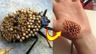 Top 10 Insectos Y Arácnidos Más Peligrosos Del Mundo [upl. by Atnovart596]