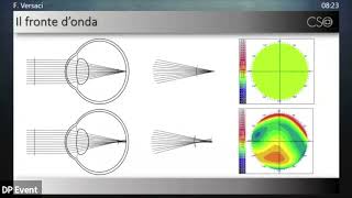 Le aberrazioni oculari di alto ordine misurazione e impatto sulla qualità della visione A Calossi [upl. by Knudson]