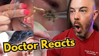 Dermatologists Reaction to Viral Pimple Popping Cyst Popping TikToks [upl. by Robet]