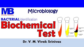 BIOCHEMICAL TEST  Bacterial Identification Technique  Microbiology  Vivek Srinivas Bacteriology [upl. by Imef617]