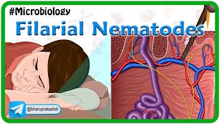 Filarial nematodes Animation🐛 Wuchereria onchocera volvulus LoaLoa Dracunculus Trichinella [upl. by Augustine806]