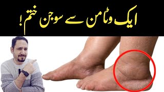 1 Vitamin To Eliminate Swelling In Feet and Legs  Dr Irfan Azeem [upl. by Schear238]