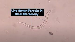 Strongyloides in Stool Microscopy [upl. by Herzig275]