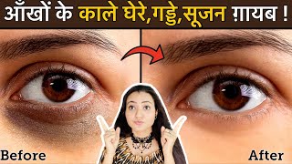 In 7 Days 💕 Remove DARK CIRCLES काले घेरे PUFFY EYES गड्ढे SUNKEN EYES Naturally  100 Results [upl. by Nevanod]