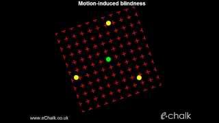 Motioninduced blindness test for the severity of ADHD  eChalk illusion [upl. by Octavian]