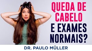 Queda de Cabelo Mesmo Com Exames Normais – Dr Paulo Müller Dermatologista [upl. by Anali]