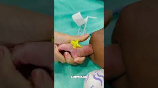 Bandeya 💉🌡️✌️ ivcannulation newbornbaby babydocter ytshorts kidsvideo injection viralvideo [upl. by Namsaj]