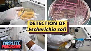 Detection of Escherichia coli E coliA Complete Procedure ISO 93081 amp ISO 16649 [upl. by Egiaf243]