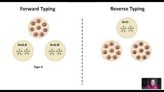 PreTransfusion Testing Type Screen and Crossmatch [upl. by Yerocaj]