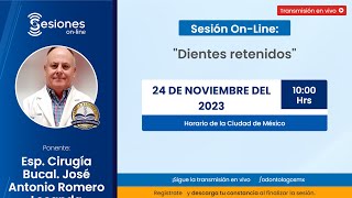 Sesión OnLine quotDientes retenidosquot [upl. by Nigle]