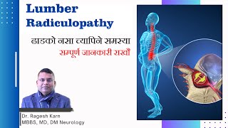 What is Lumbar Radiculopathy  ढाडको नसा च्यापिने समस्यासम्पूर्ण जानकारी राखौ  By Dr Ragesh Karn [upl. by Ynetruoc195]