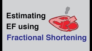 Estimating Ejection Fraction using Fractional Shortening with Cardiac UltrasoundEchocardiography [upl. by Ennalyrehc]