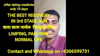 The best recovery in 3rd stage Avn patient  3rd stage Avn theek huwaavascular avn [upl. by Neelyk]