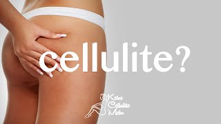 ✅ 5 Prinzipien um Ihre Cellulite zu eliminieren 2016 [upl. by Handbook62]