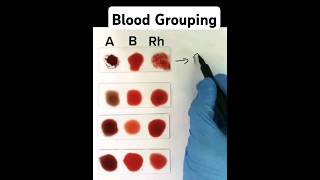 Blood Grouping made easy [upl. by Pebrook534]