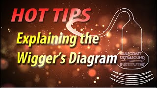 Explaining the Wiggers Diagram [upl. by Amalle]