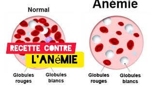 Remède naturel pour traiter lanémie par Afrique Pharmacopée [upl. by Nyllij]