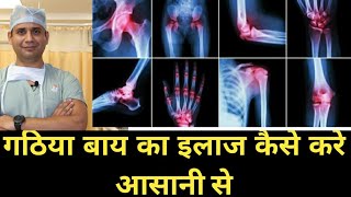 गठिया बाय का पूरा इलाज सरल हिंदी में पहली बार complete information of Rheumatoid Arthritis [upl. by Nuriel]