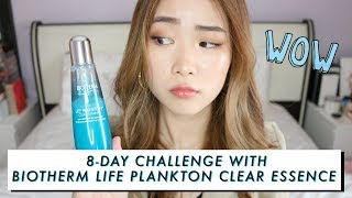 HOW I TRANSFORM MY SKIN IN 8 DAYS  BEFORE amp AFTER [upl. by Ylrebmit336]