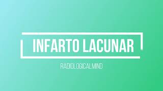 INFARTO LACUNAR [upl. by Noryv]